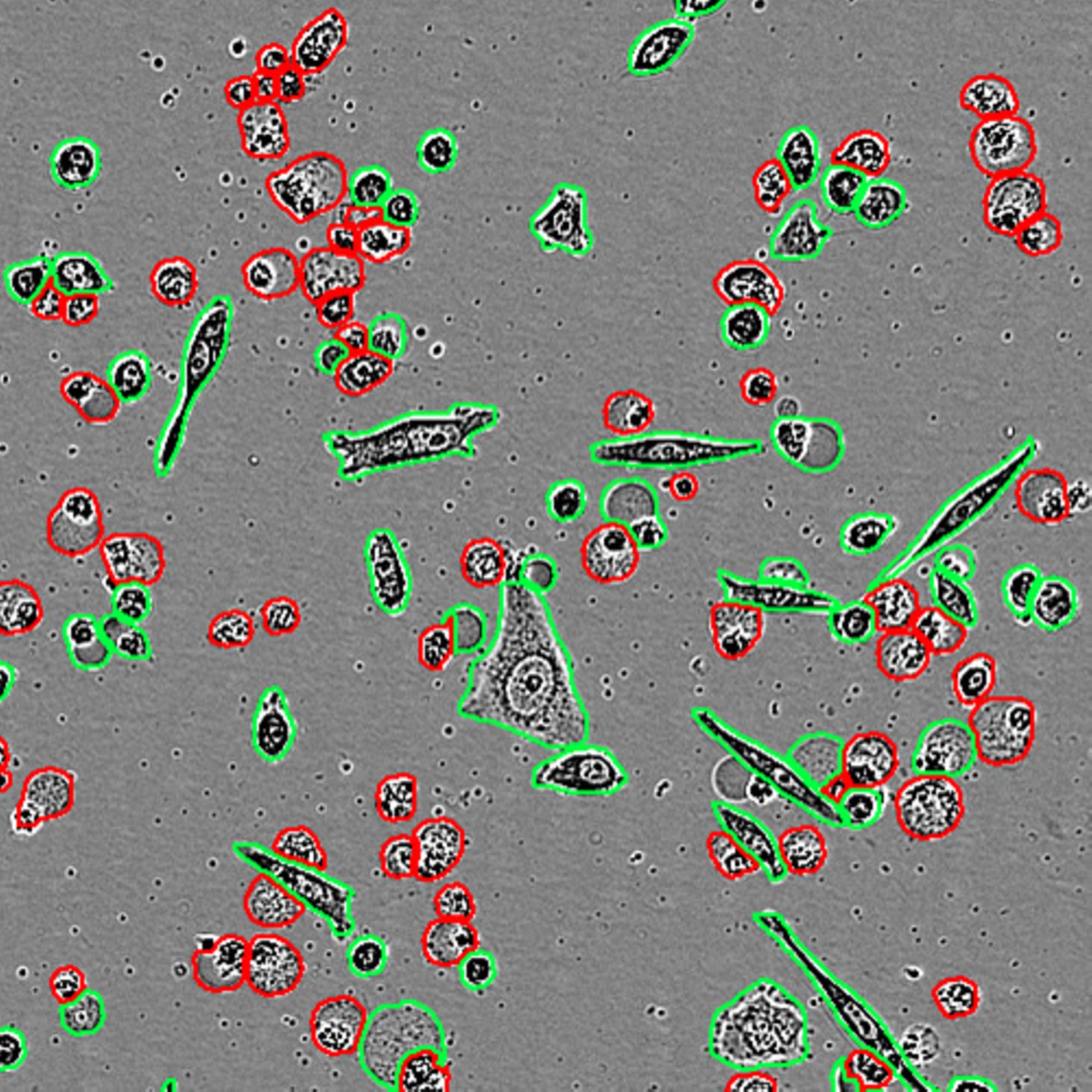 How Artificial Intelligence is Solving the “Cell Analysis Problem” in ...